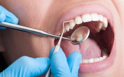 Not Sure if You have a Cavity? Here’s How to Check