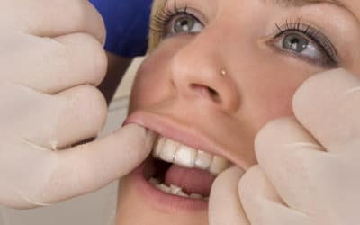 Getting Invisalign Braces for Your Teenager
