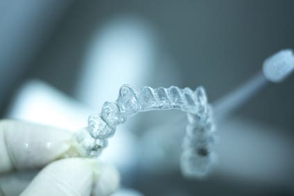 questions about Invisalign