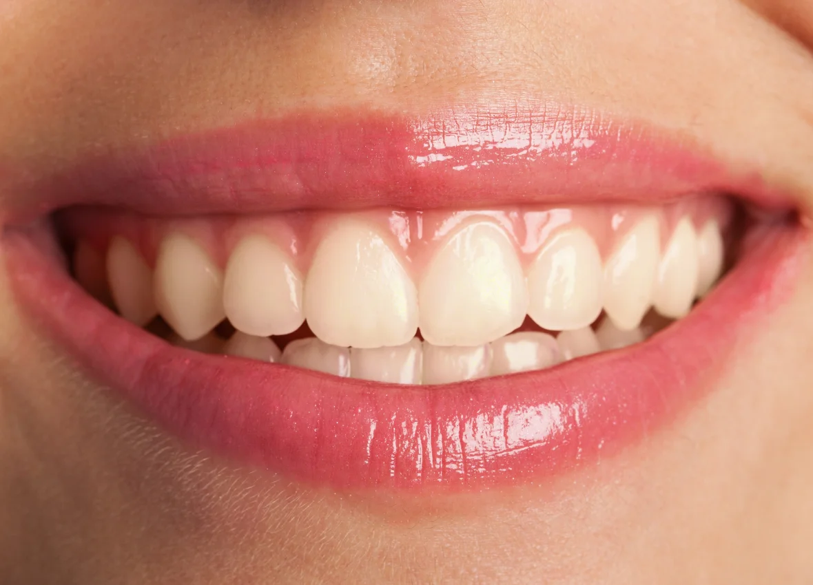 home-before teeth