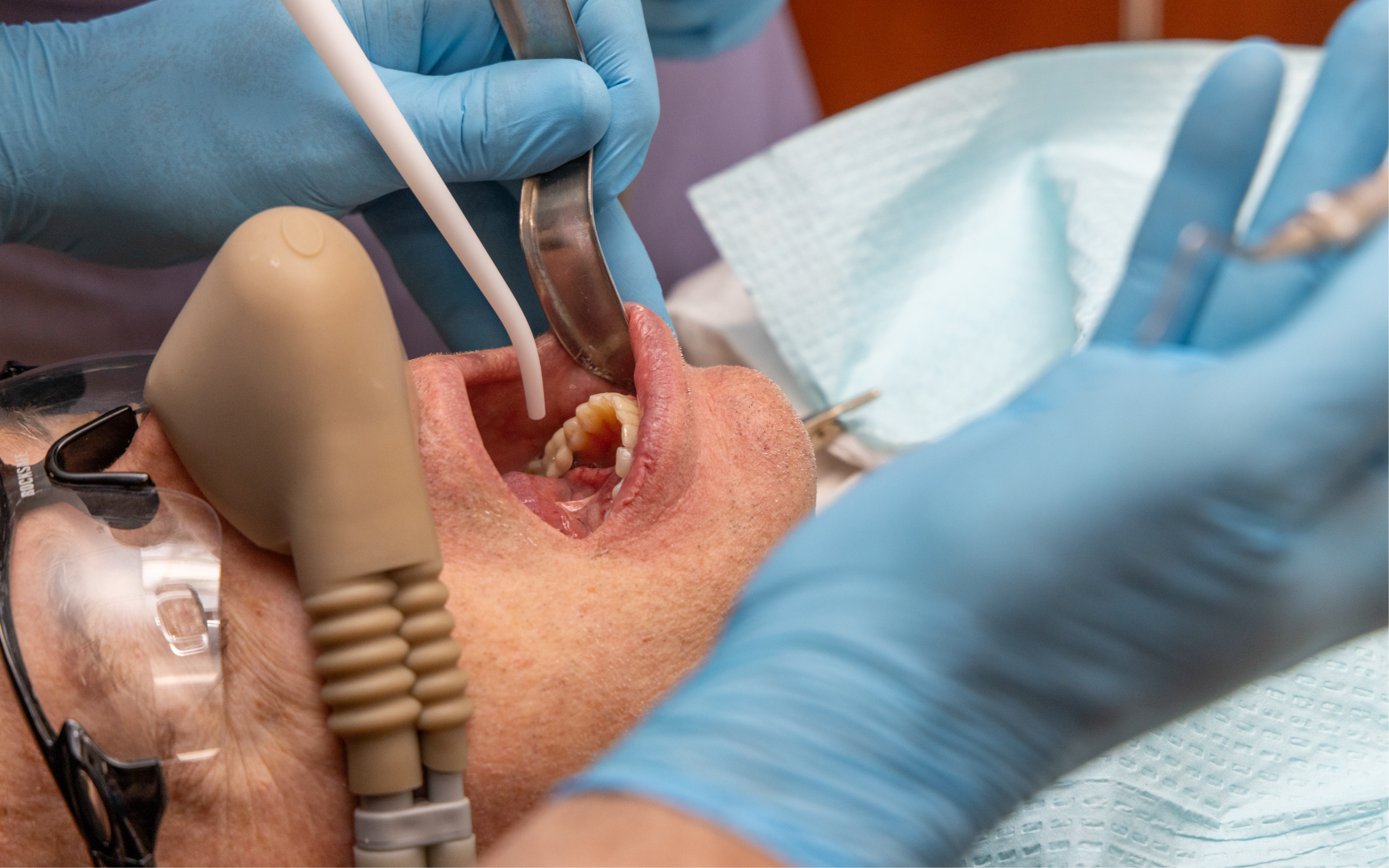Sedation Dentistry