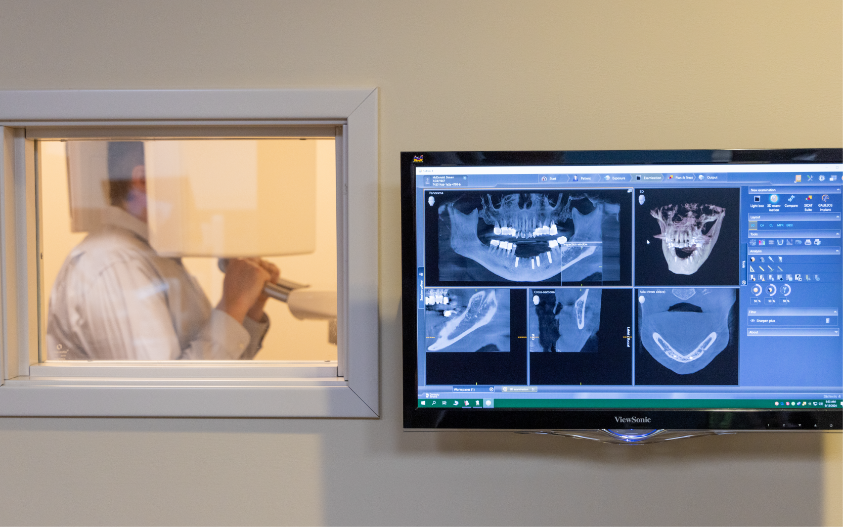 Dental Imaging & Mapping x-ray